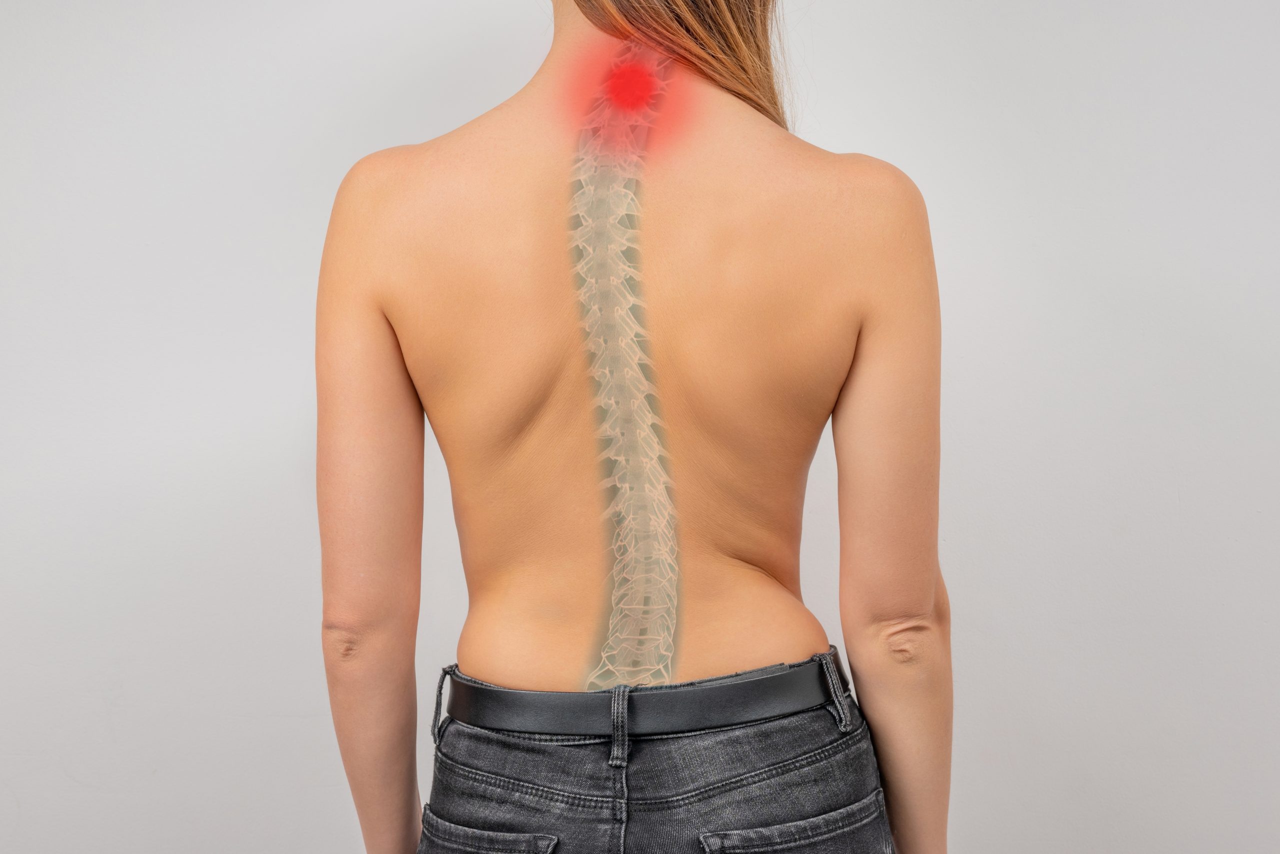 Cervical Lordosis Chiropractic Treatment Near Lynnwood, WA